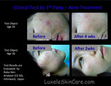 Luxele® Blemish Clarifying Serum